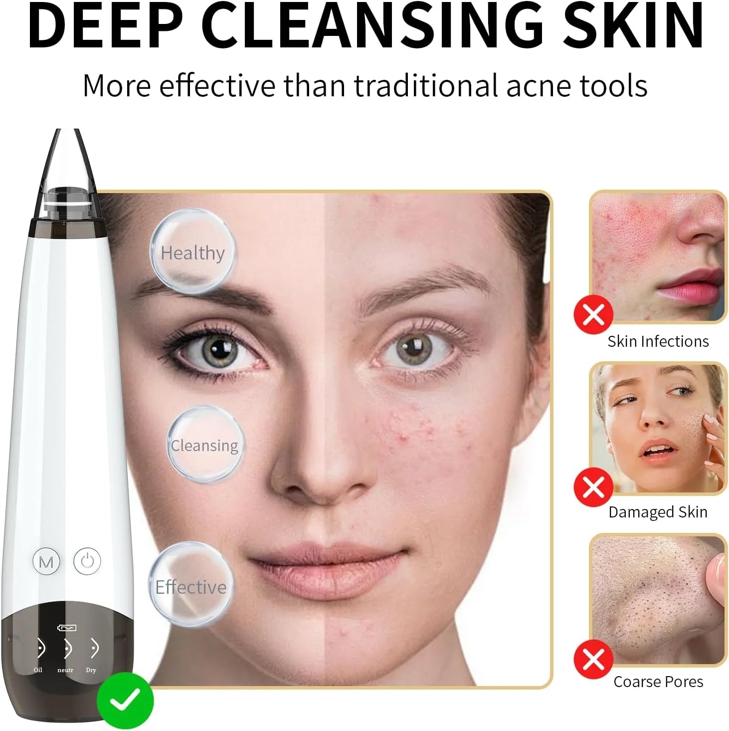 Upgraded Version Blackhead Remover Pore Vacuum Cleaner Pimple Extractor - Facial Pore Cleaner Pore Extractor, USB Rechargeable Blackhead Remover Vacuum with 5 Probes
